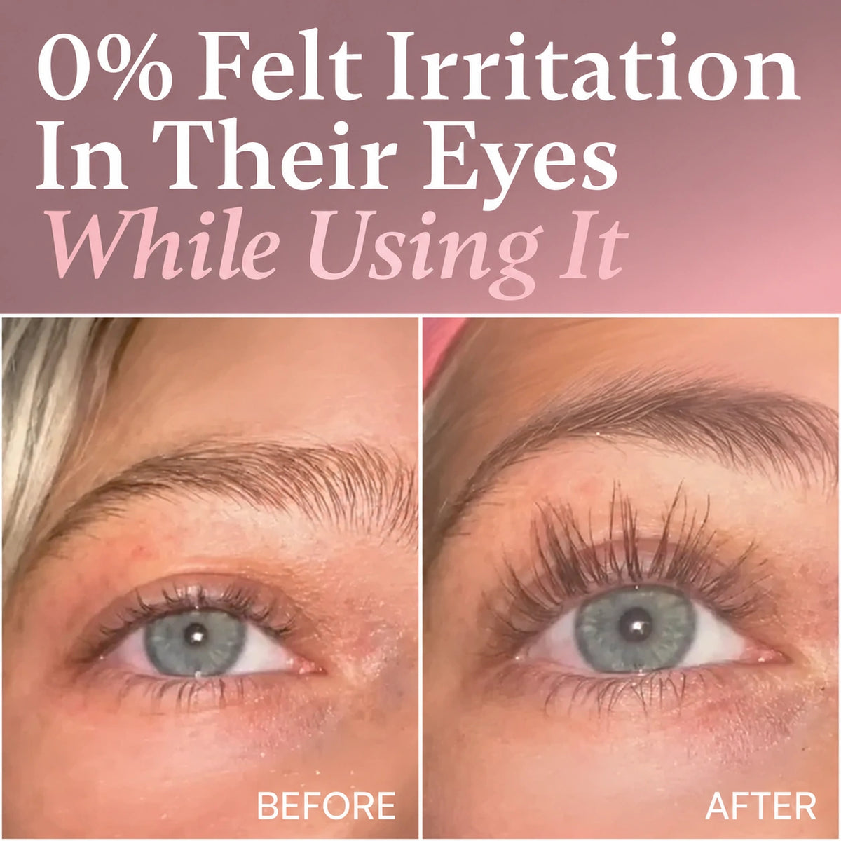 zero irritation